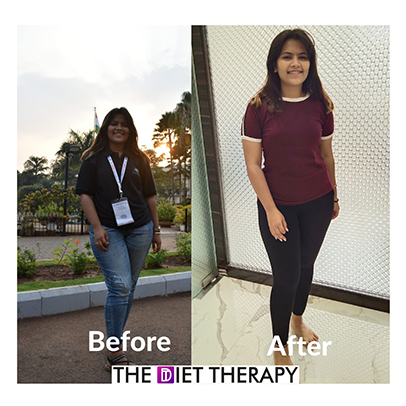 Before and After weight loss journey through The Diet Therapy program