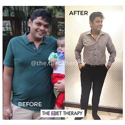 Before and After weight loss journey through The Diet Therapy program