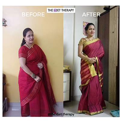 Before and After weight loss journey through The Diet Therapy program