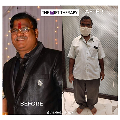 Before and After weight loss through The Diet Therapy program