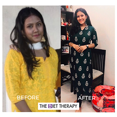 Before and After weight loss journey through The Diet Therapy program