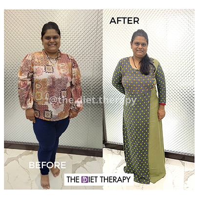 Before and After weight loss journey through The Diet Therapy program