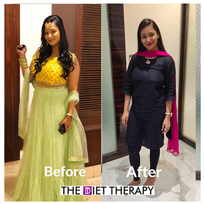 Before and After weight loss journey through The Diet Therapy program